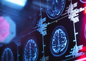 Groundbreaking Study Offers Lafora Disease Hope